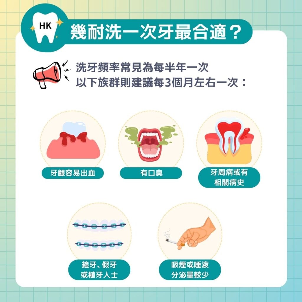 幾耐洗一次牙最合適？