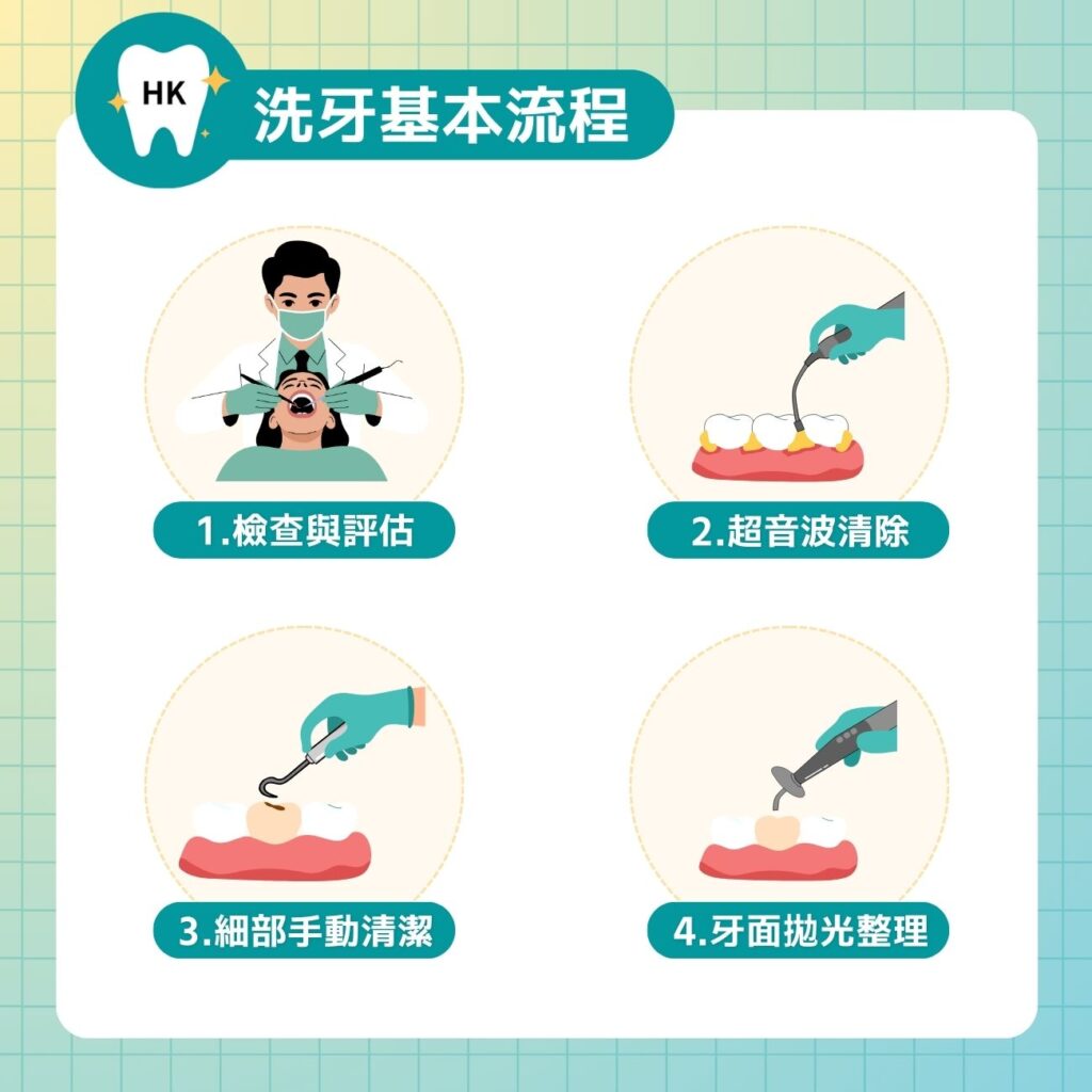 洗牙基本流程