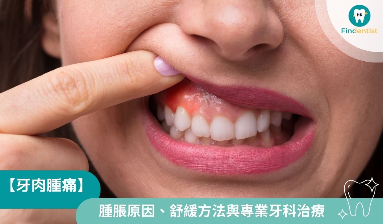 【牙肉腫痛】6大常見腫脹原因、舒緩方法與專業牙科治療一文看清