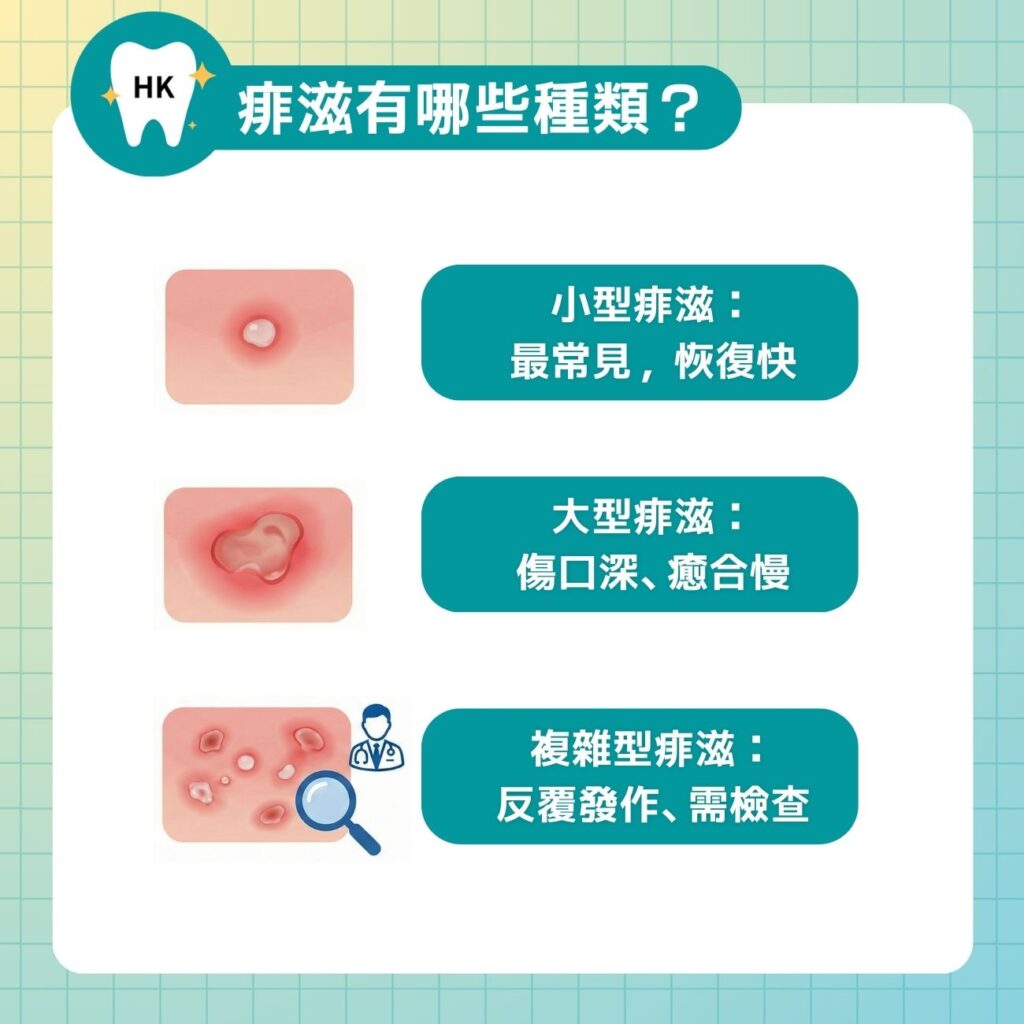 痱滋有哪些種類？