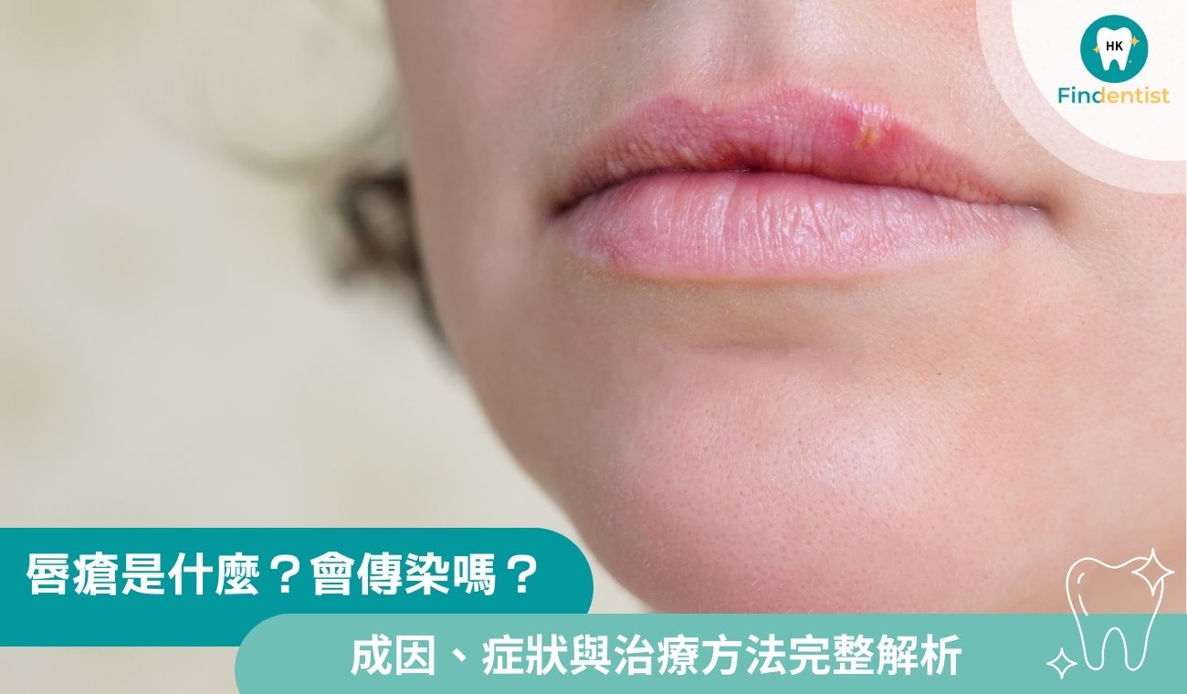 唇瘡是什麼？會傳染嗎？4大成因、症狀與治療方法完整解析