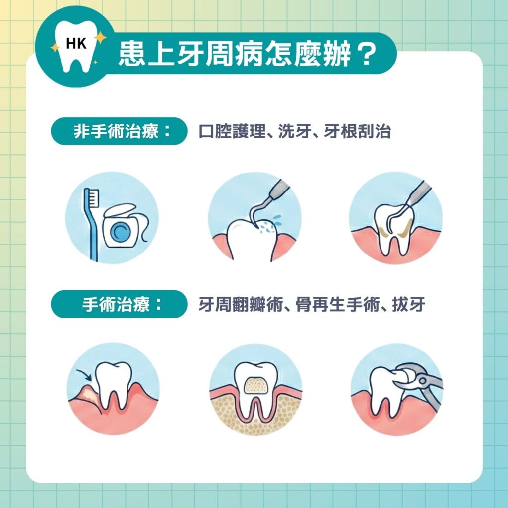 患上牙周病怎麼辦？