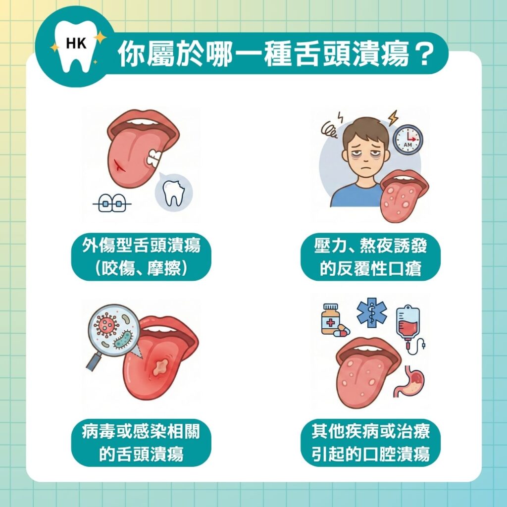 你屬於哪一種舌頭潰瘍？