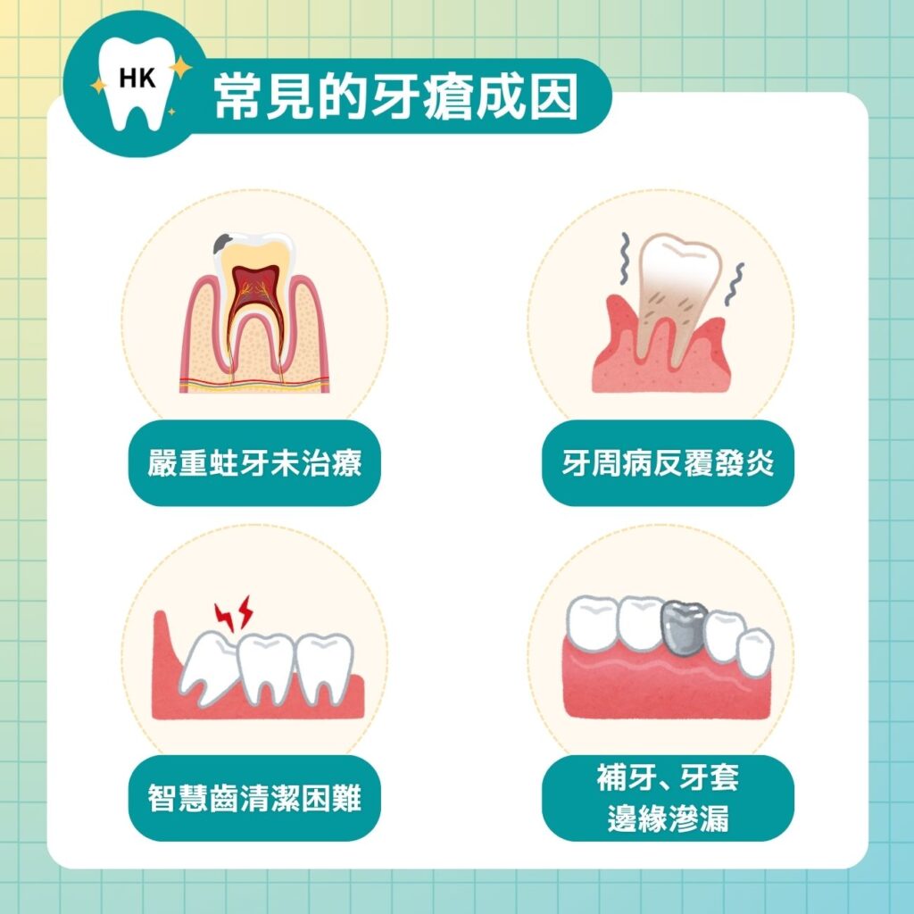 常見的牙瘡成因