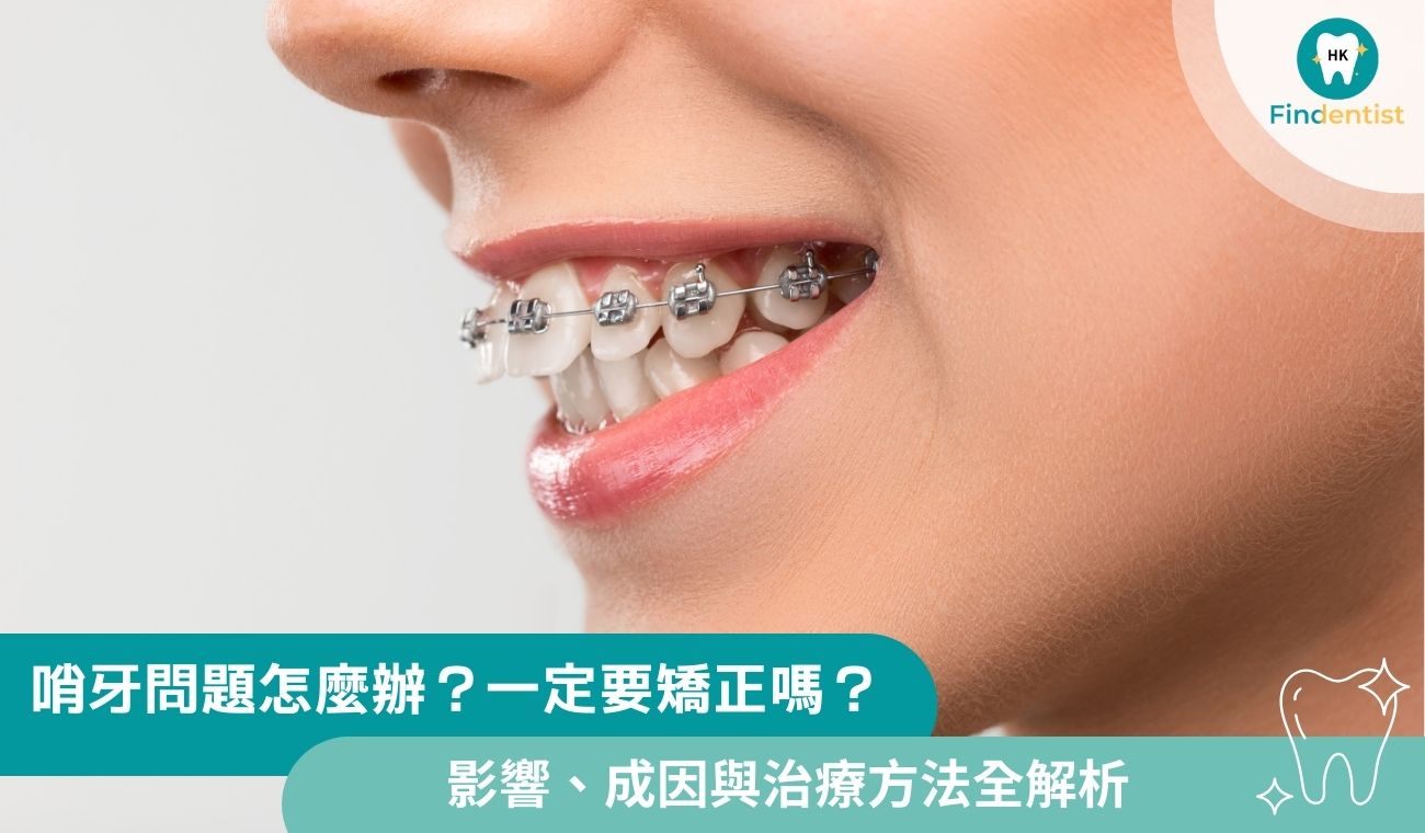 哨牙問題怎麼辦？一定要矯正嗎？ 3 大影響、成因與治療方法全解析