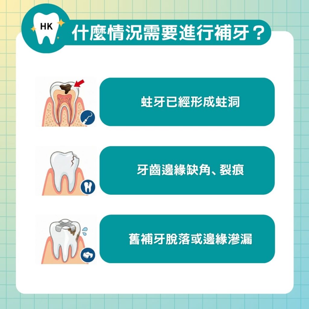 什麼情況需要進行補牙？
