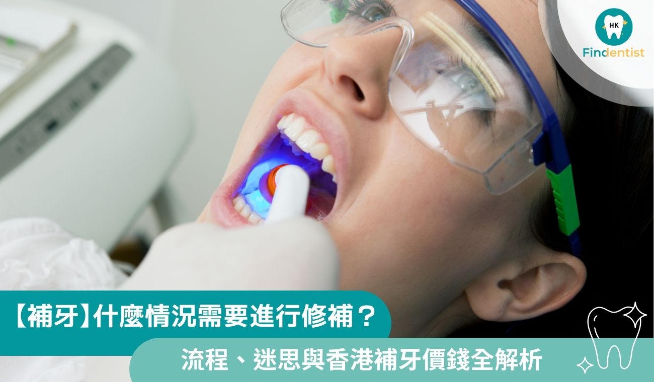 什麼情況需要 補牙？牙科流程、迷思與 香港補牙價錢全解析
