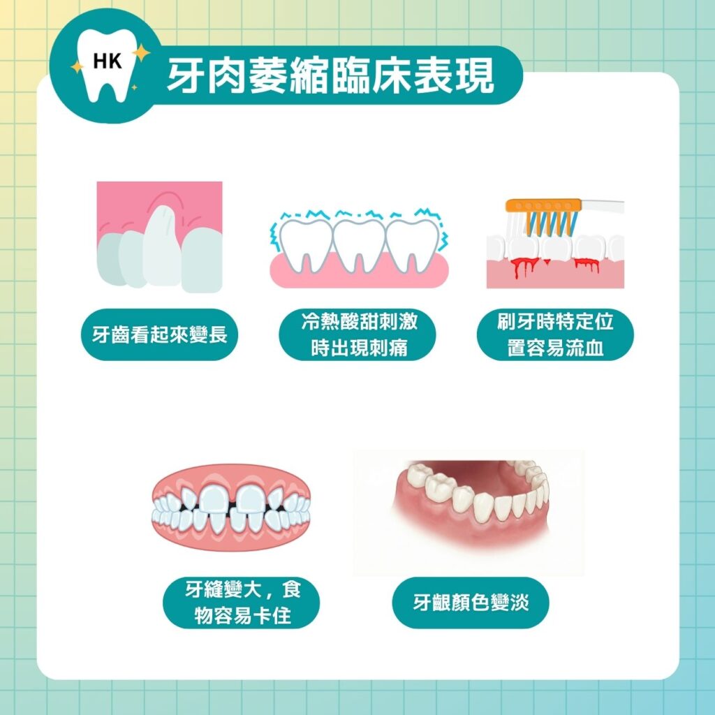 牙肉萎縮臨床表現