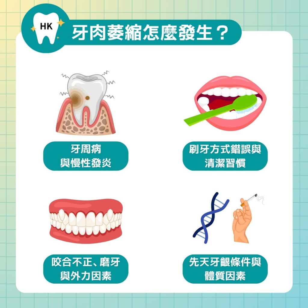 牙肉萎縮怎常見風險因素與原因