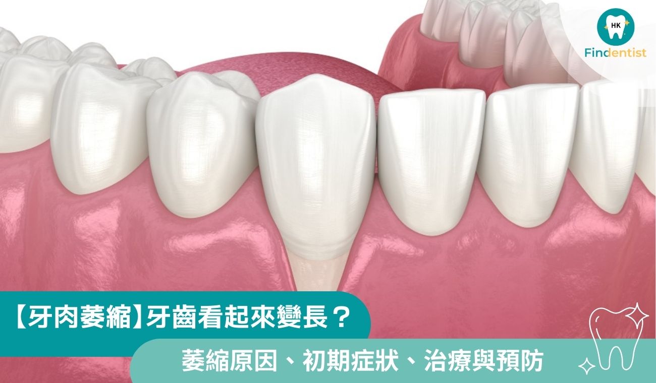 【牙肉萎縮】牙齒看起來變長？萎縮原因、初期症狀、治療與預防全解析