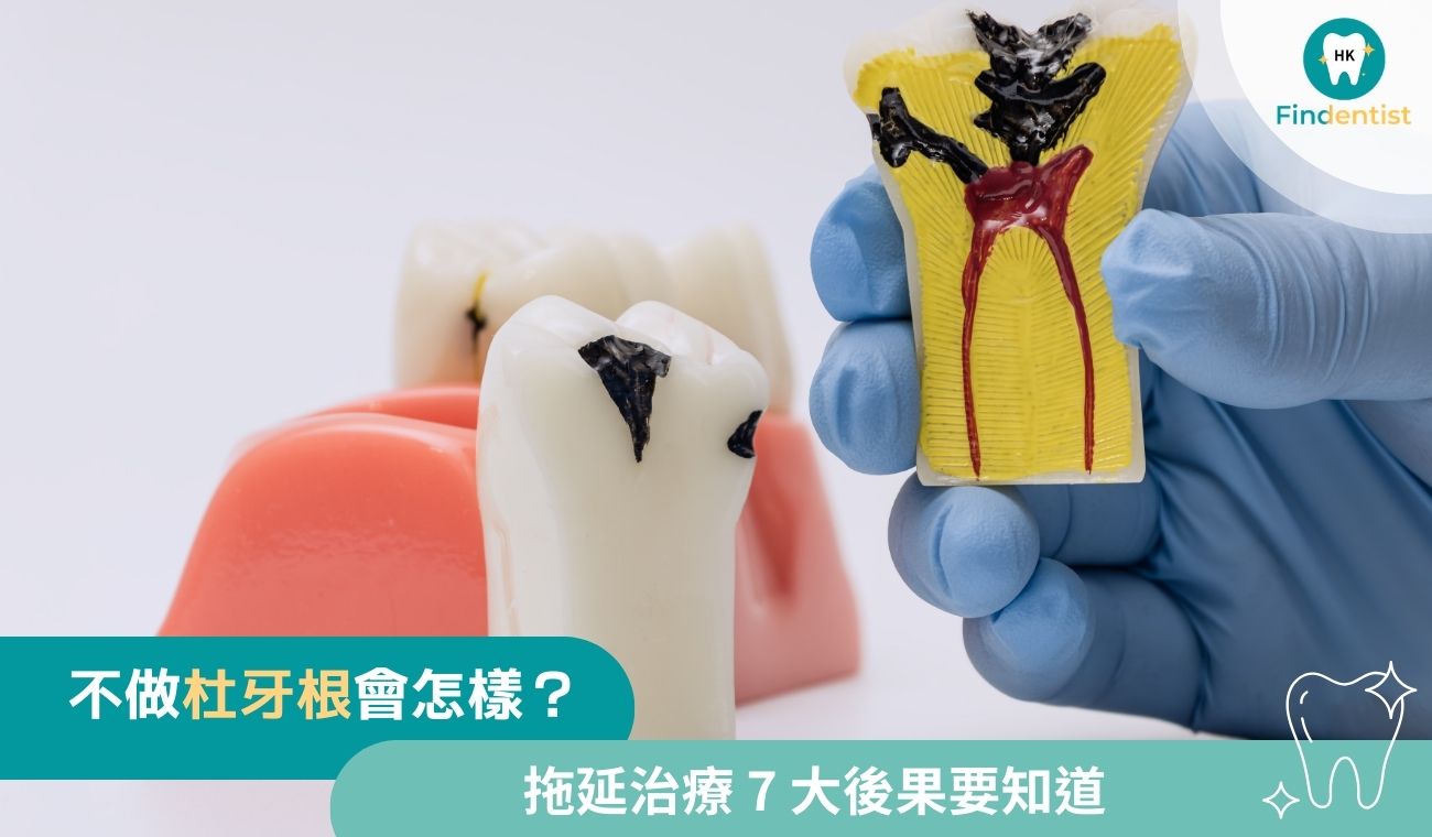 牙髓感染不做杜牙根會怎樣？拖延治療7大後果｜好牙醫