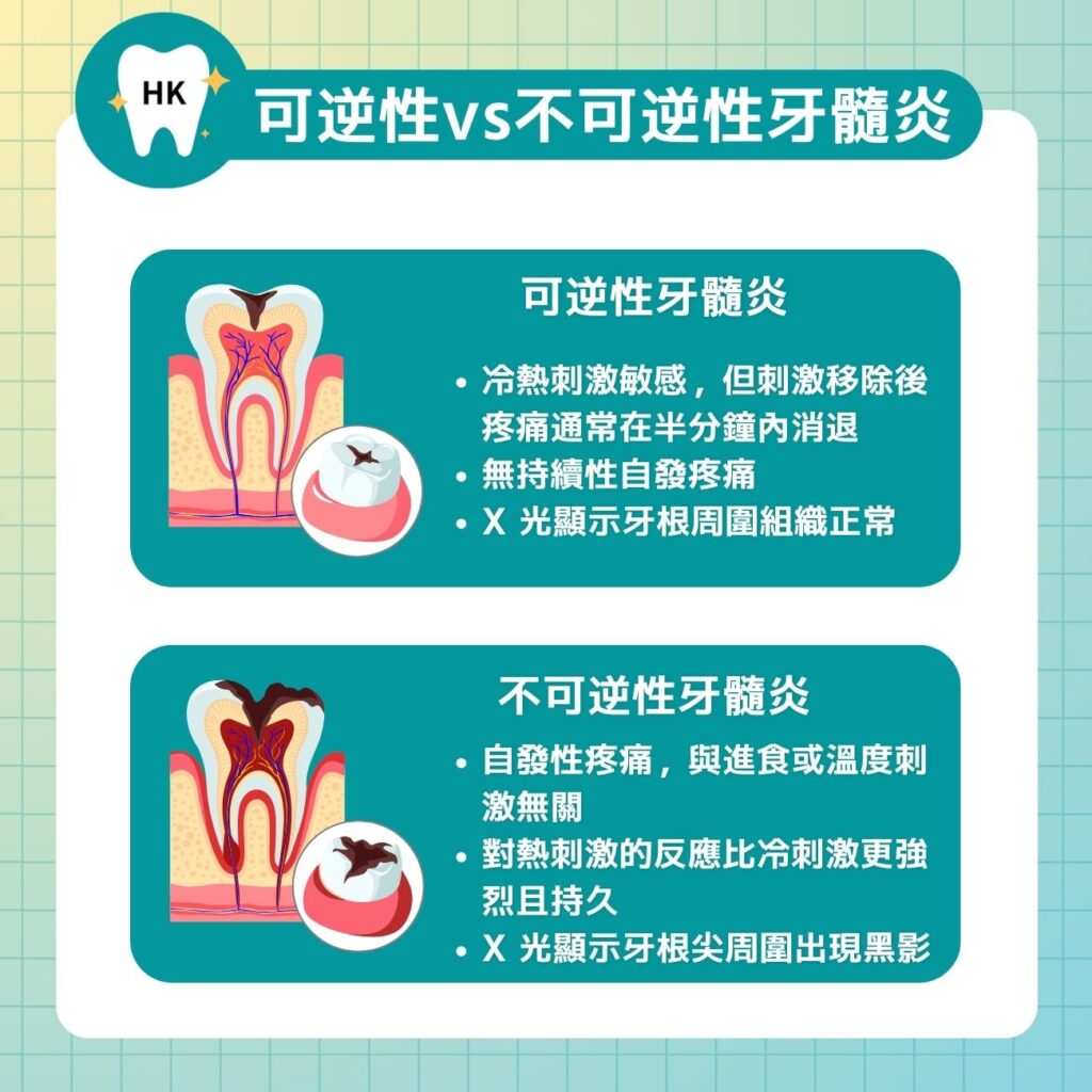 可逆性 vs 不可逆性牙髓炎