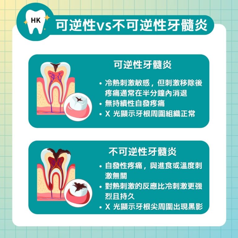 牙髓炎跟杜牙根有什麼關係?一文看清可逆性 vs 不可逆性的差異|好牙醫