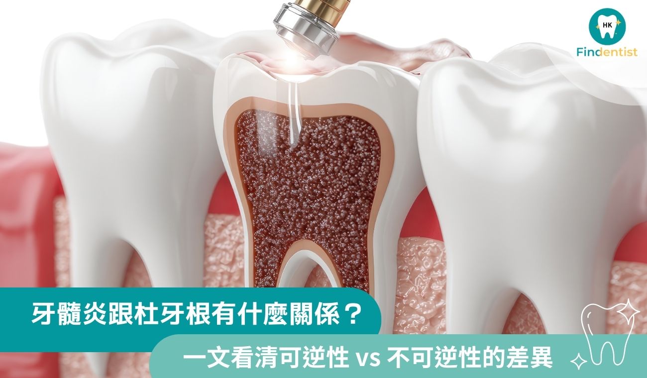 牙髓炎跟杜牙根有什麼關係？一文看清可逆性 vs 不可逆性的差異
