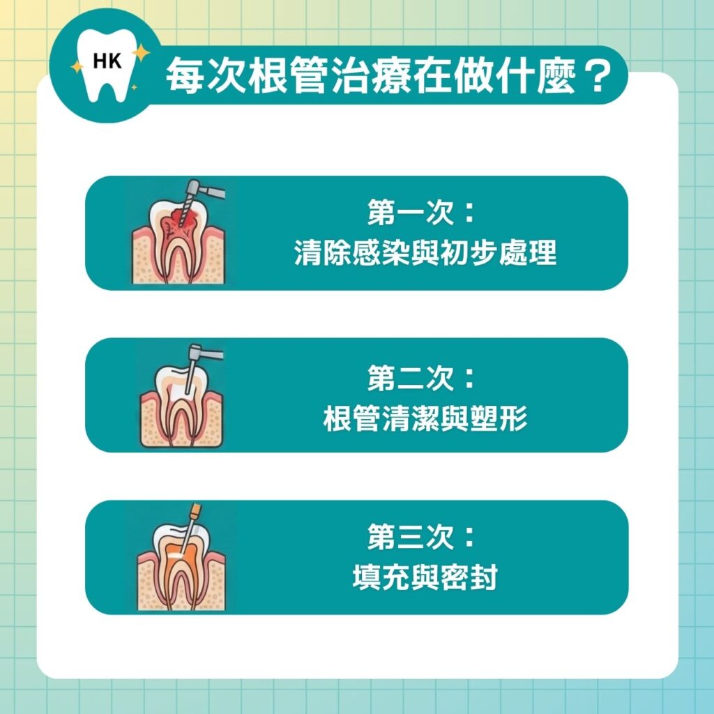 每次根管治療都在做什麼？
