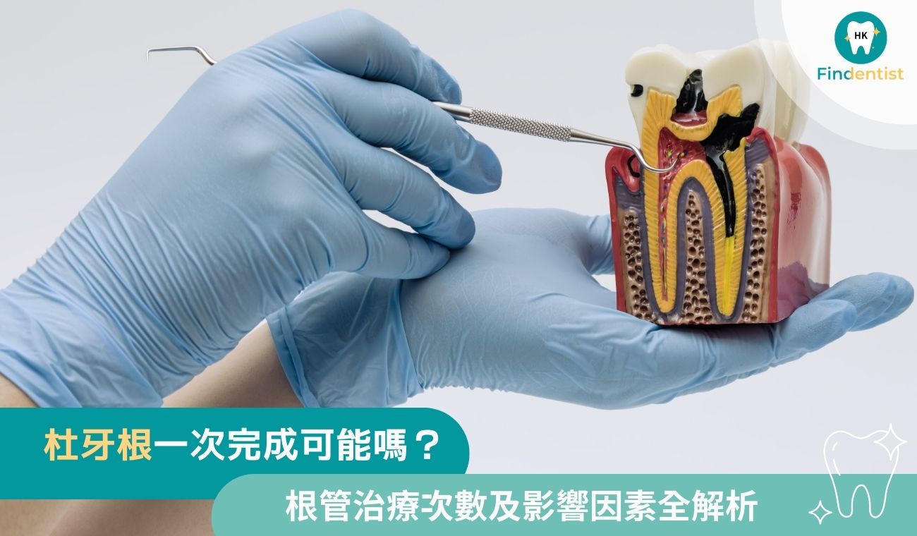 杜牙根一次完成？根管治療次數及影響因素全解析｜好牙醫