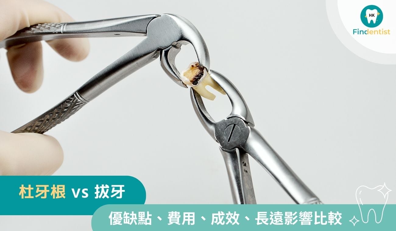 杜牙根 vs 拔牙：費用、成效、長遠影響比較｜好牙醫