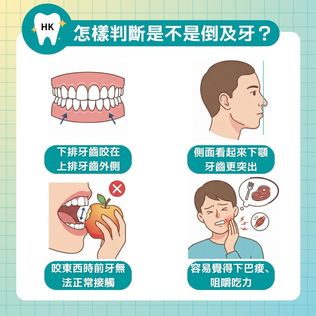 怎樣判斷自己是不是倒及牙？
