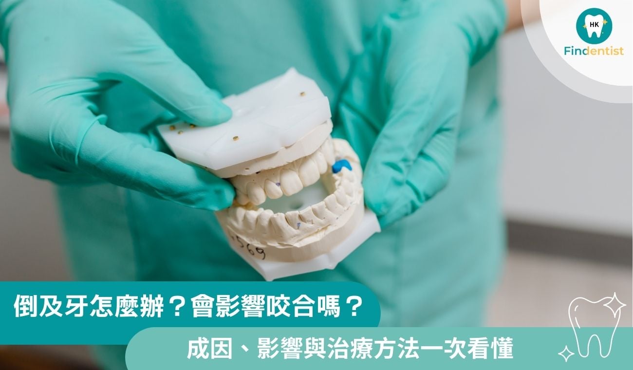 倒及牙怎麼辦？會影響咬合嗎？2大成因、影響與治療方法一次看懂