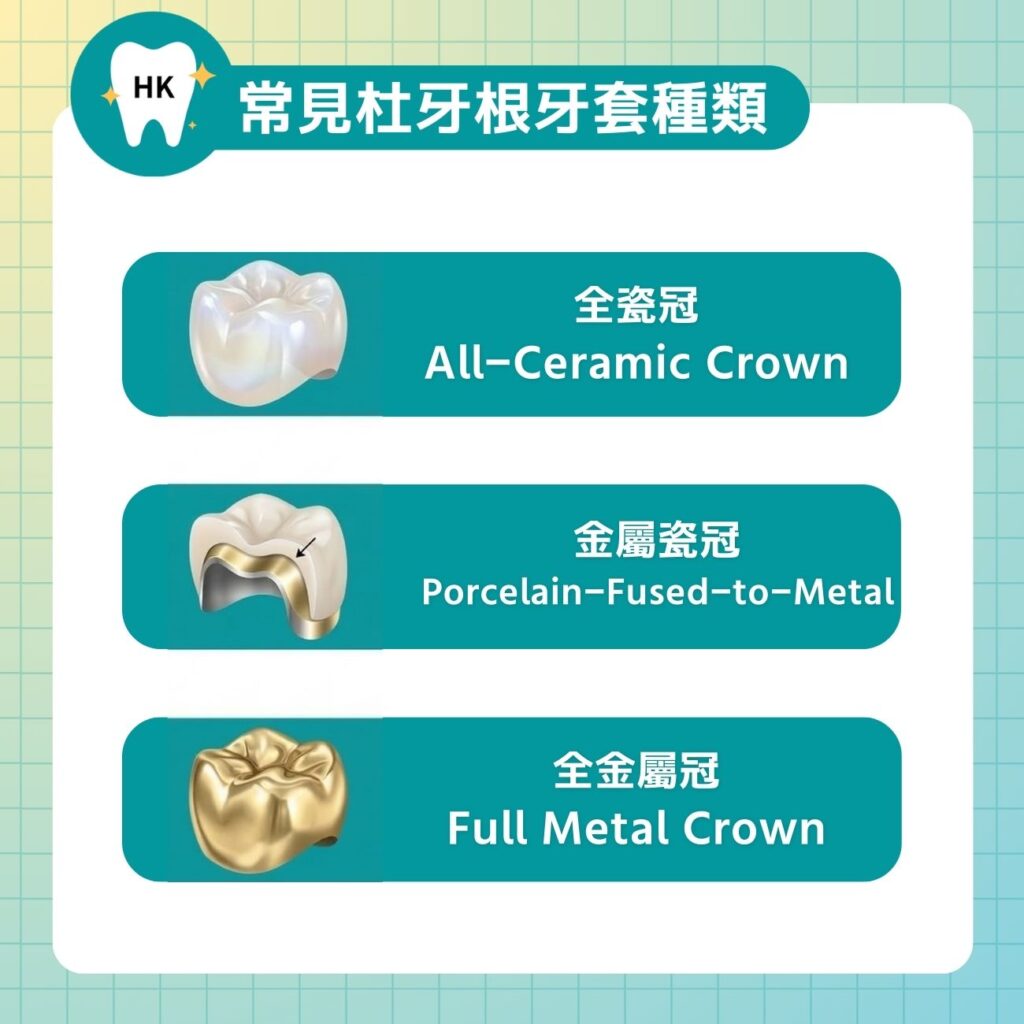 常見杜牙根牙套種類