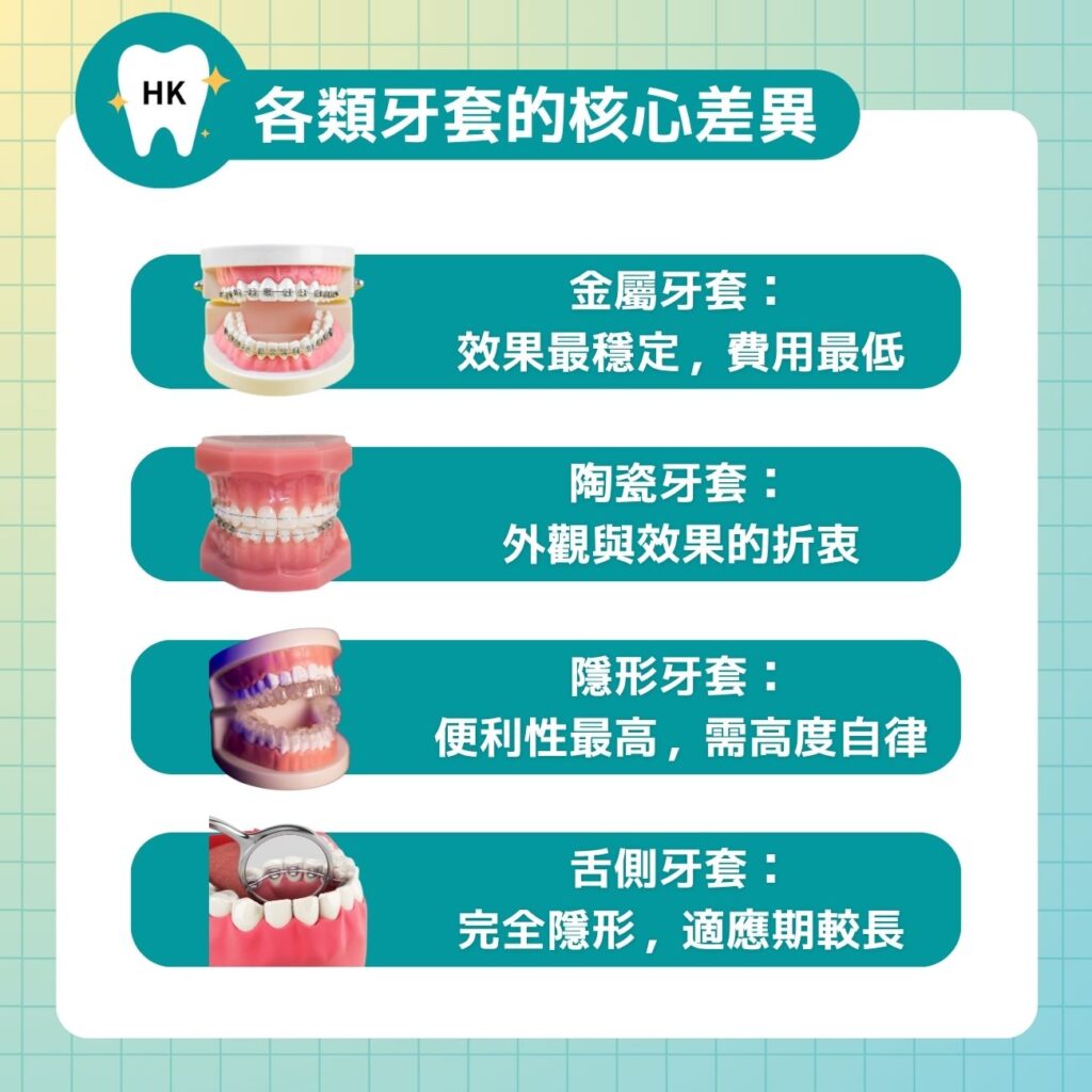 各類牙套的核心差異