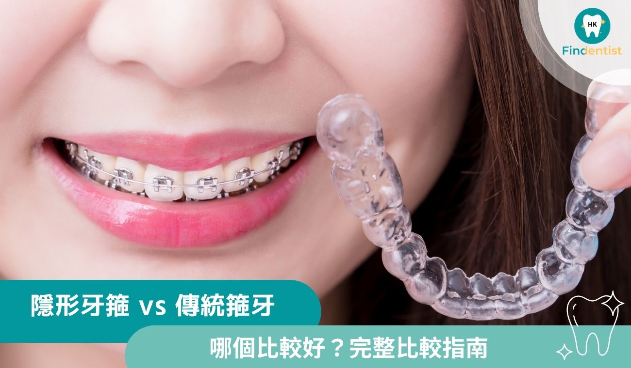 隱形牙箍vs傳統箍牙：哪個比較好？完整比較指南｜好牙醫