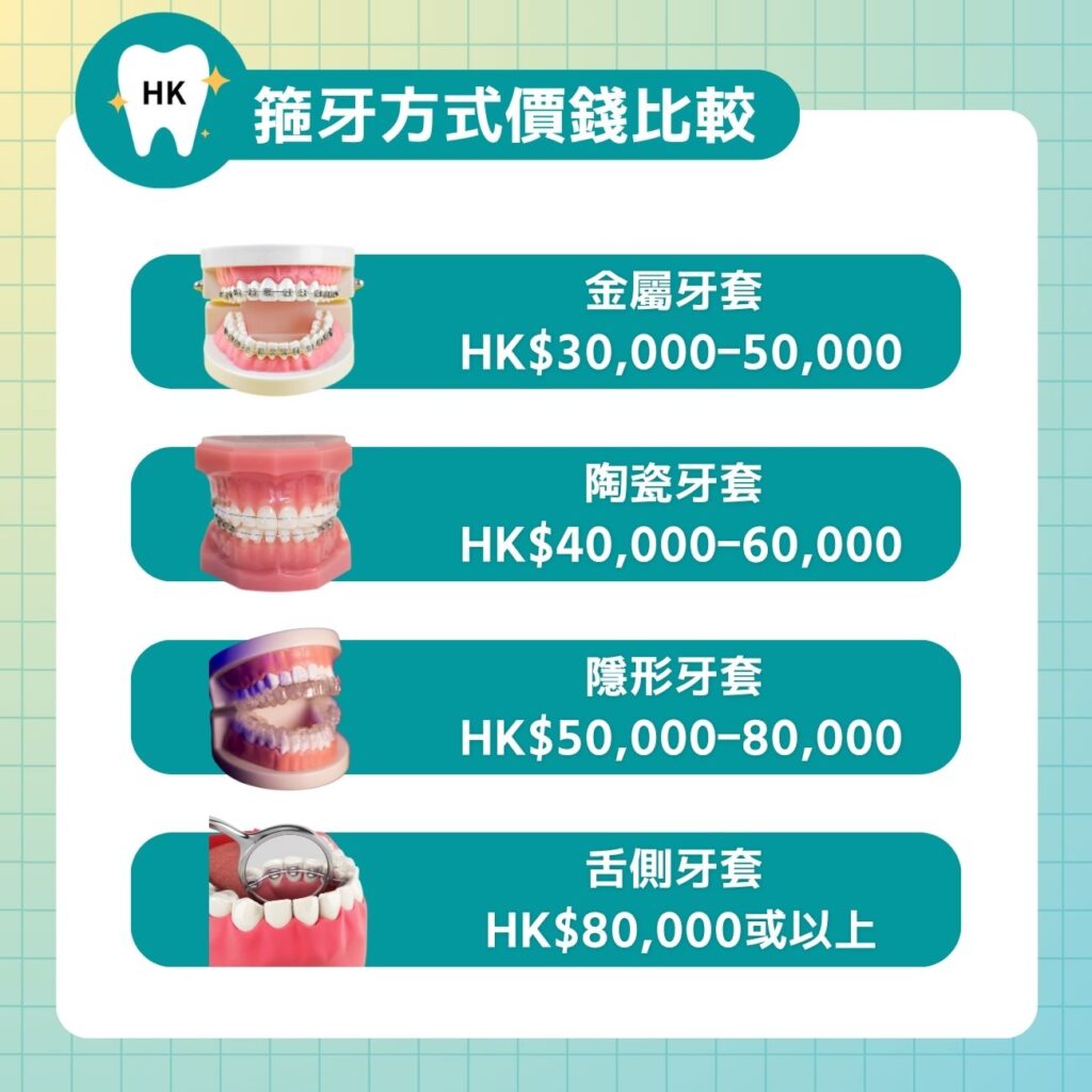 箍牙方式價錢比較