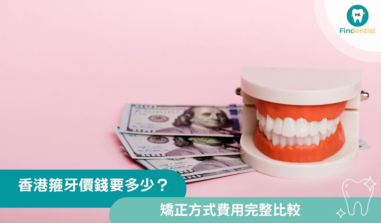 香港箍牙價錢：4種牙套費用完整比較｜好牙醫