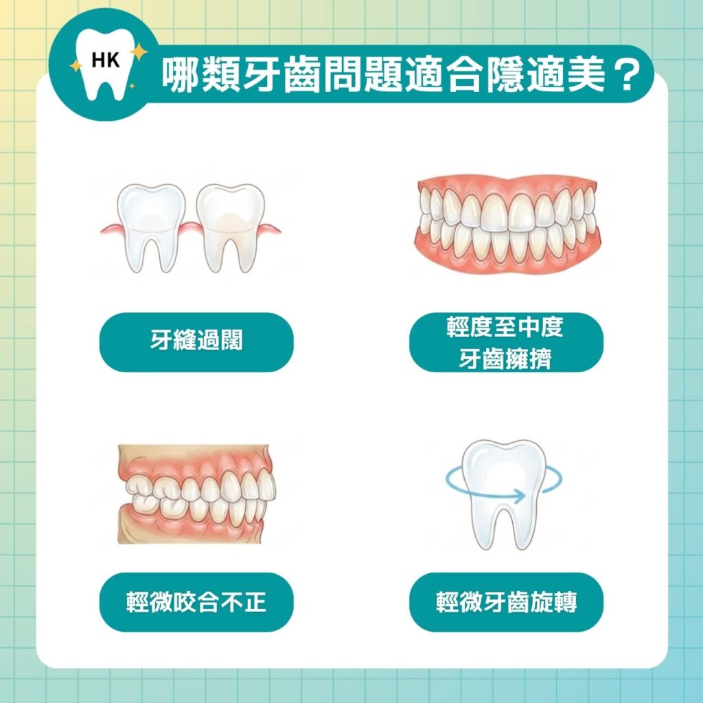 哪類牙齒問題適合做 Invisalign？
