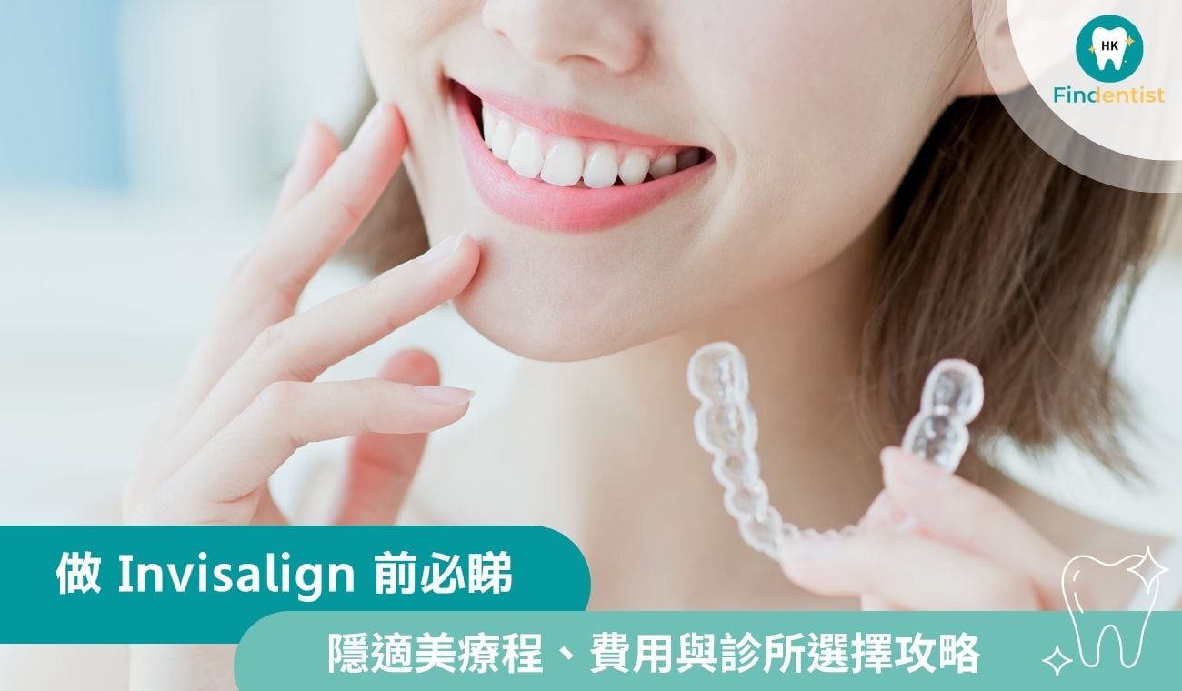 做 Invisalign 前必睇！隱適美療程、香港費用與診所選擇攻略｜好牙醫