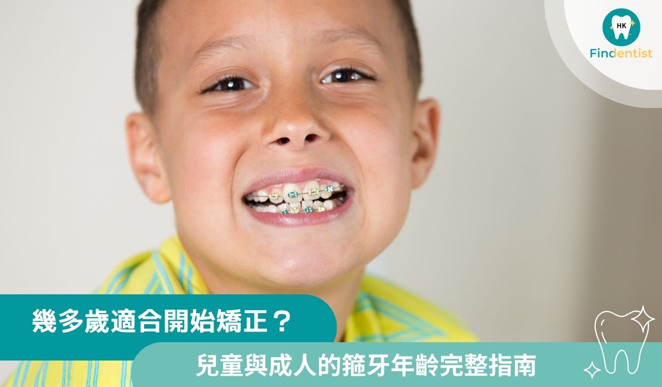 幾多歲適合矯正？兒童與成人箍牙年齡完整指南｜好牙醫