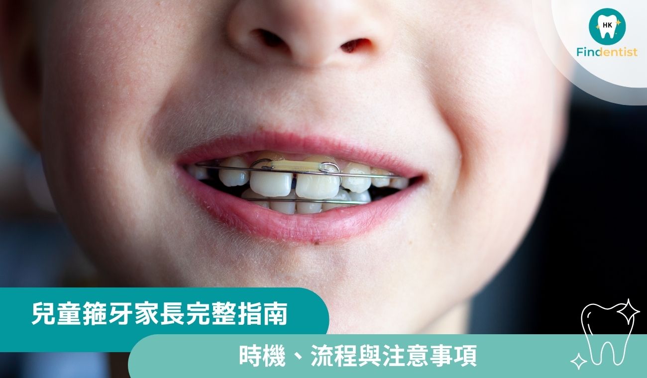 兒童箍牙完整指南：最佳時機、流程與家長須知｜好牙醫