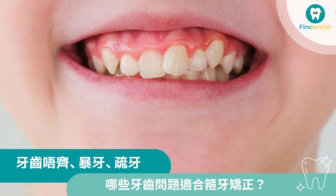 倒及牙、暴牙、疏牙：哪些牙齒問題適合箍牙矯正？｜好牙醫