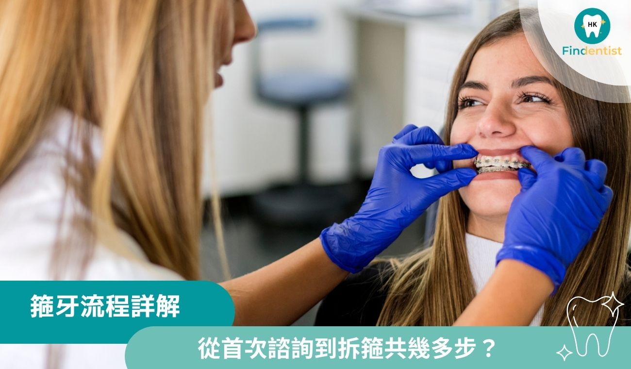 箍牙流程詳解：從首次諮詢到拆箍共幾多步？｜好牙醫
