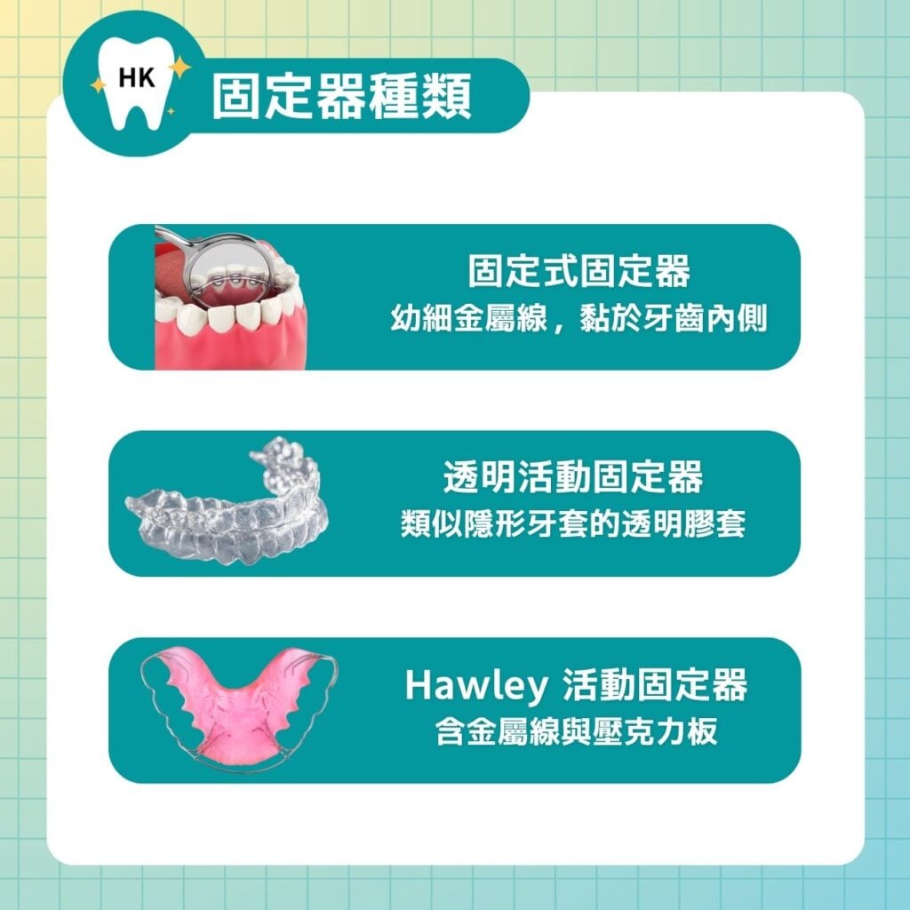 固定器種類有哪些?