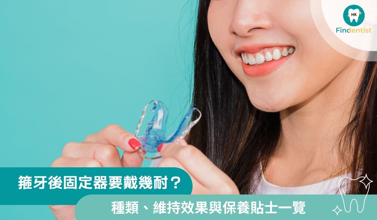 箍牙後固定器要戴幾耐？種類、維持效果與保養貼士一覽