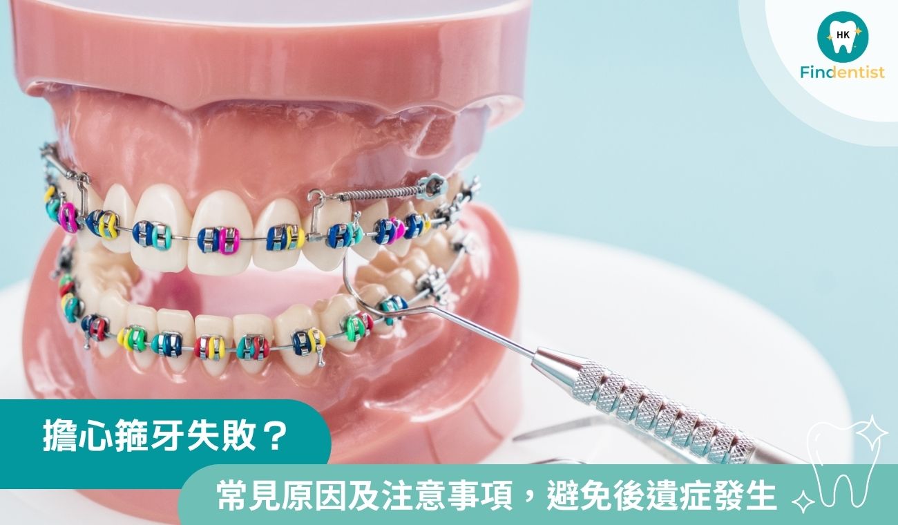 擔心箍牙失敗？5大原因及注意事項，避免後遺症發生｜好牙醫