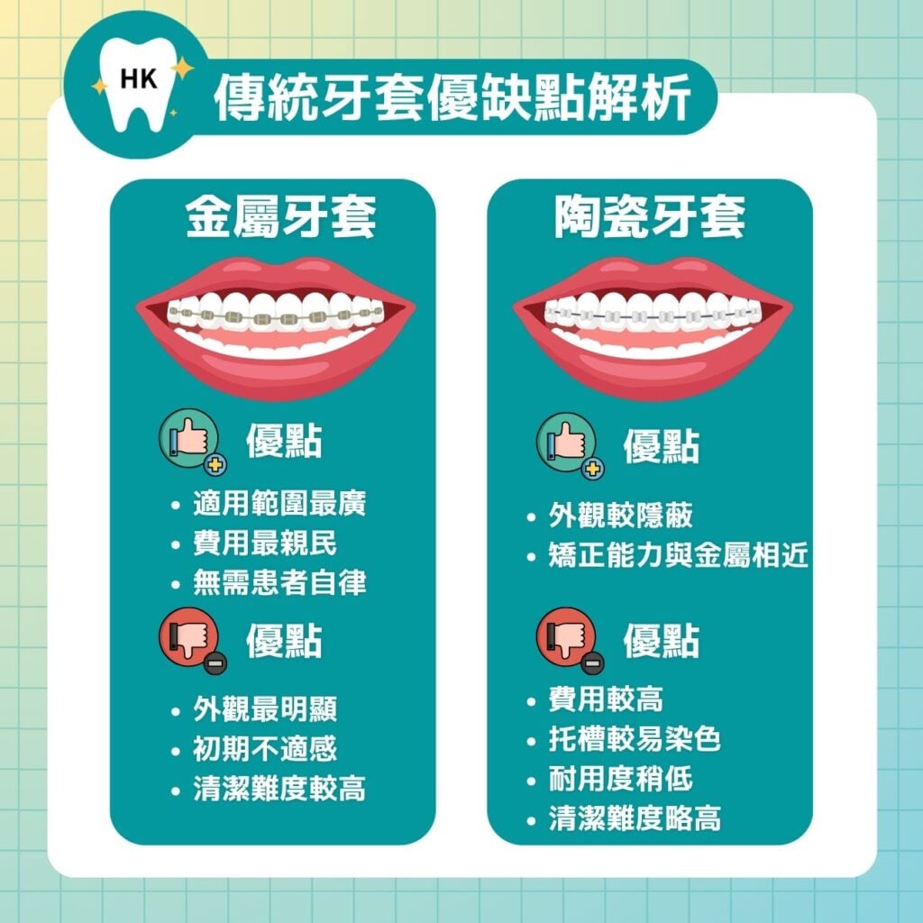 傳統牙套優缺點解析