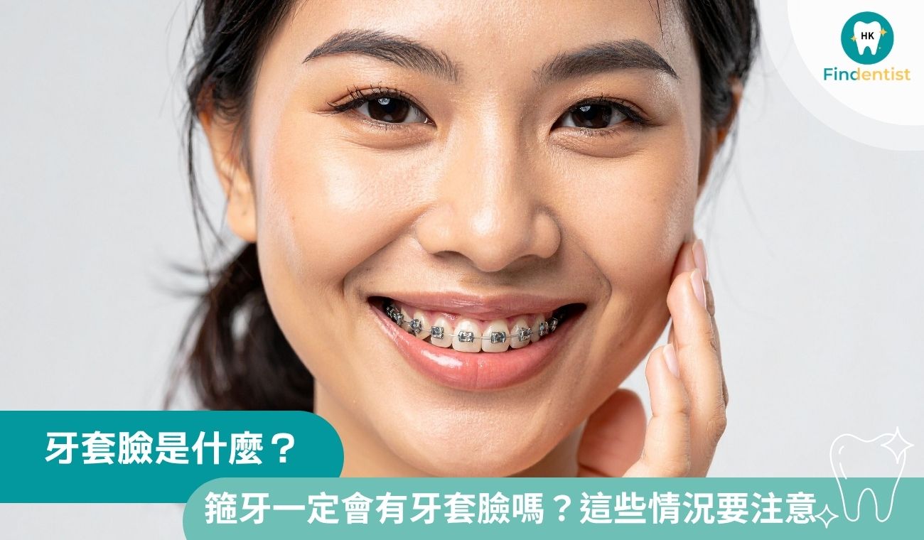 牙套臉是什麼？箍牙一定會有牙套臉嗎？4大情況要注意